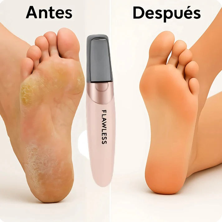 REMOVEDOR DE CALLOS PROFESIONAL
